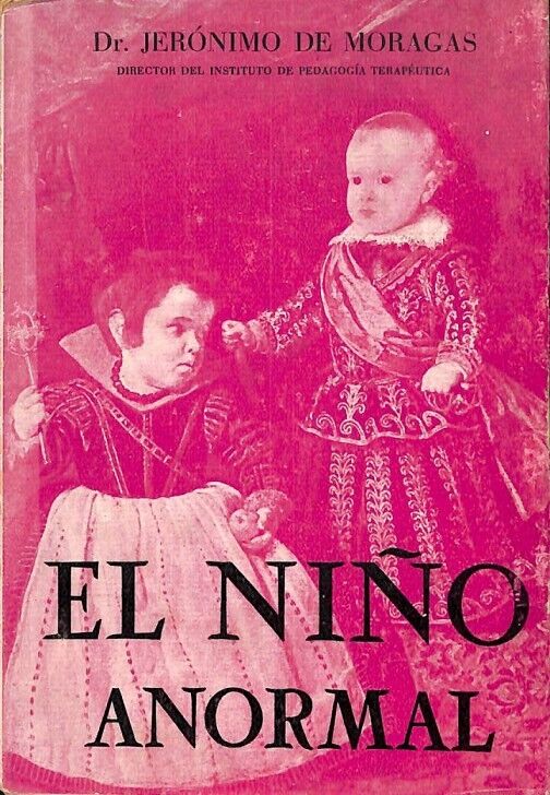 El Niño Anormal
