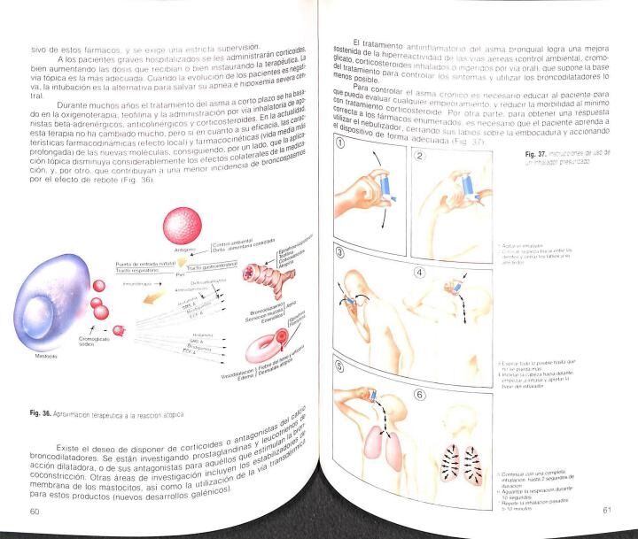 Bronquitis Crónica (Revisión y Actualización)