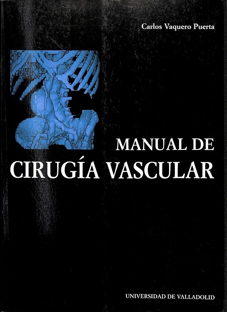 Manual de cirugía vascular