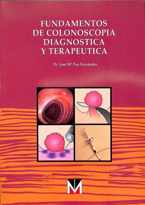 Fundamentos de Colonoscopia Diagnóstica y Terapéutica