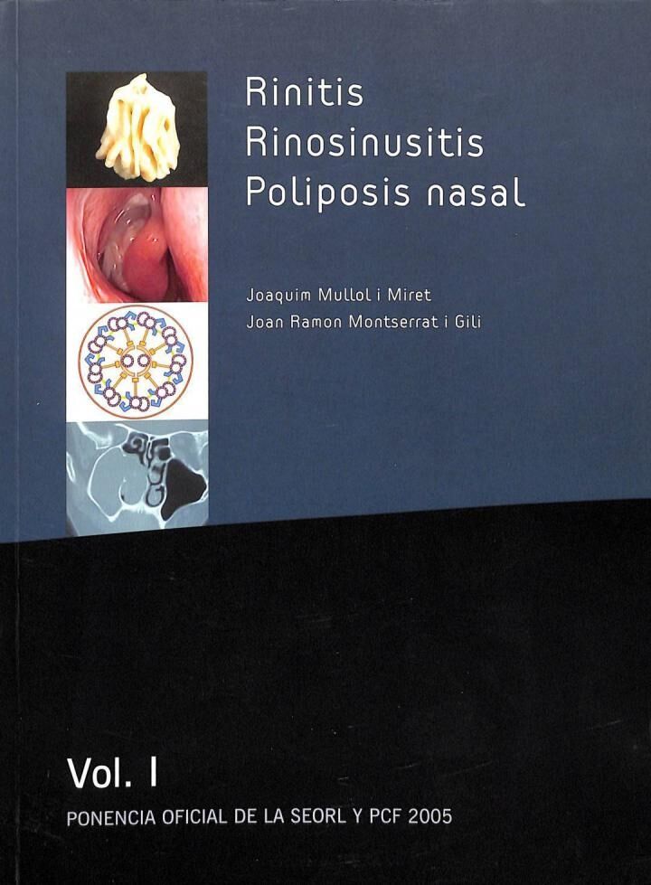 Rinitis, Rinosinusitis, Poliposis Nasal Volumen i