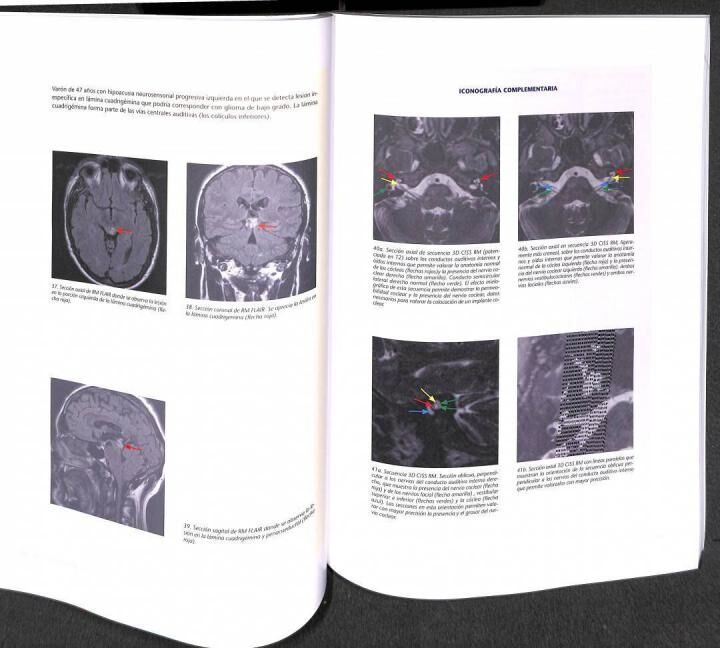 Sentidos: Atlas de Neuroimagen