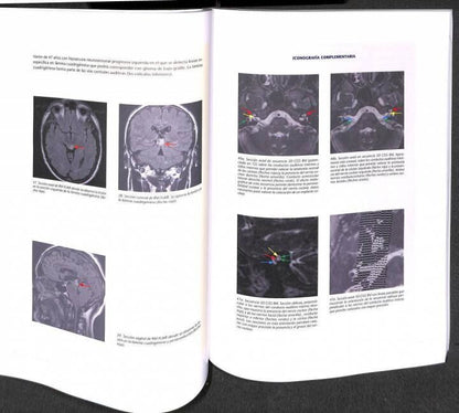 Sentidos: Atlas de Neuroimagen