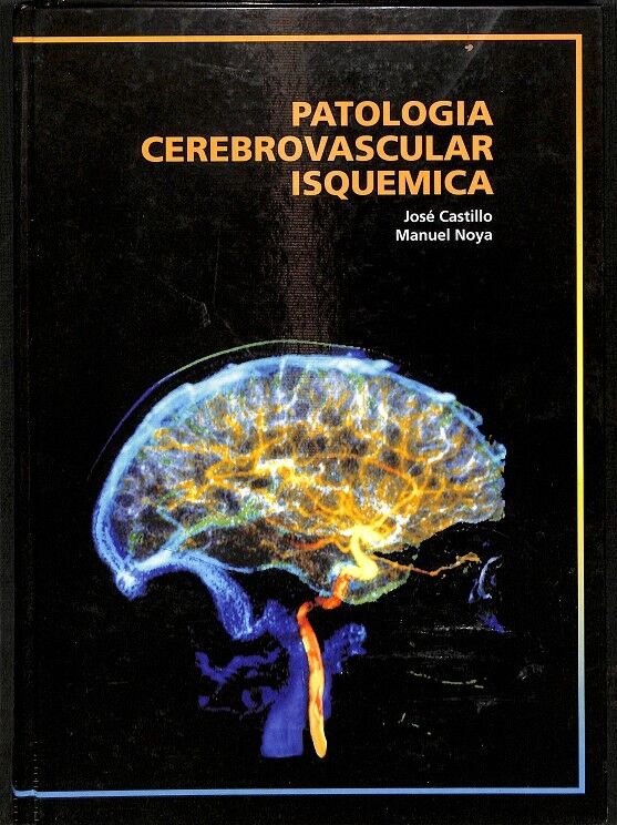 Patologis Cerebrovascular Isquemica