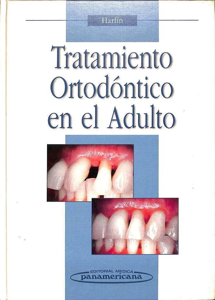 Tratamiento Ortodontico en el Adulto