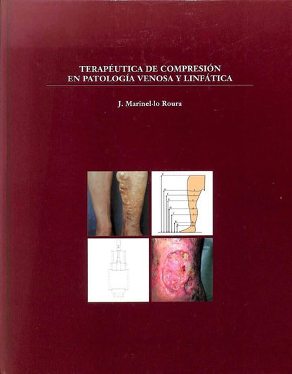 Terapéutica de Comprensión en Patología Venosa y Linfática