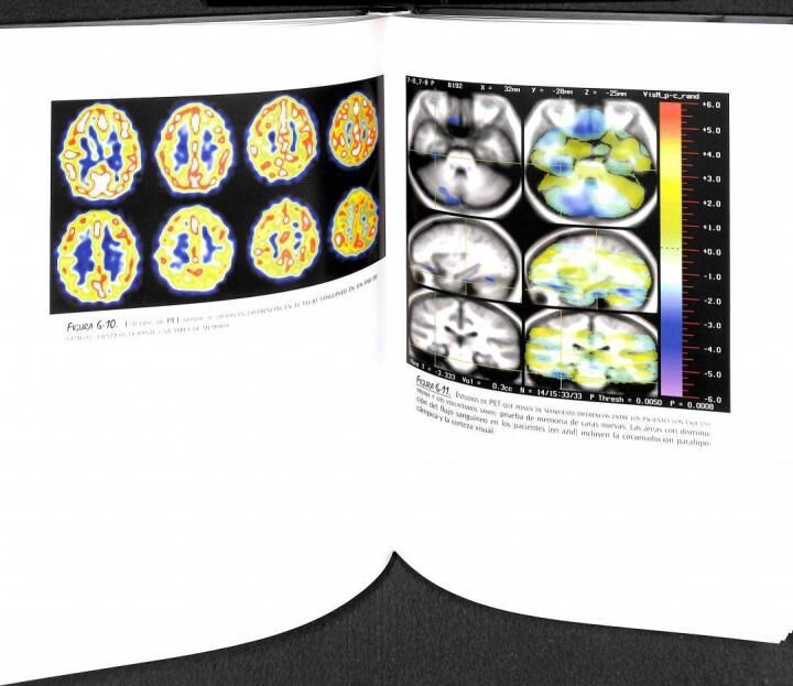 Un Cerebro Feliz la Conquista de la Enfermedad Mental en la Era del Genoma