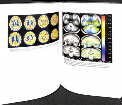 Un Cerebro Feliz la Conquista de la Enfermedad Mental en la Era del Genoma