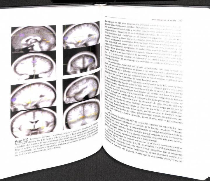 Un Cerebro Feliz la Conquista de la Enfermedad Mental en la Era del Genoma