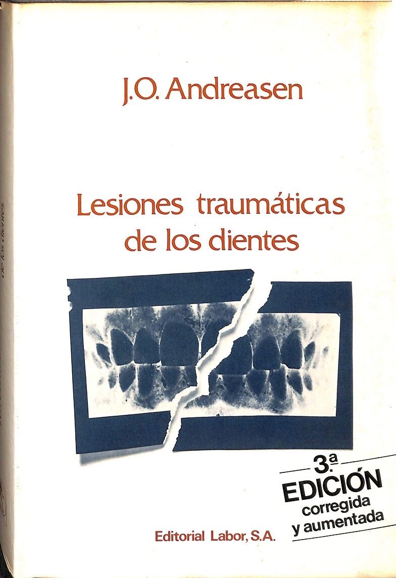 Lesiones Traumáticas de los Dientes