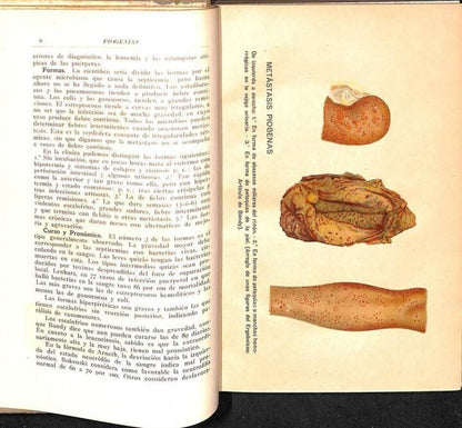 Patología Quirúrgica Tomo i Infecciones