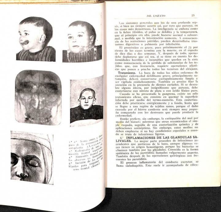 Patología Quirúrgica Tomo i Infecciones