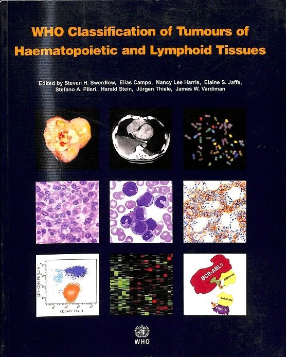 Who Classification Of Tumours Of Haematopoietic And Lymphoid Tissues -