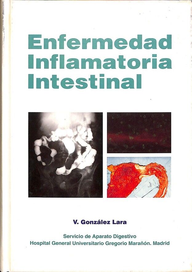 Enfermedad Inflamatoria Intestinal