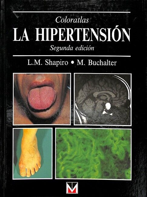 La Hipertension