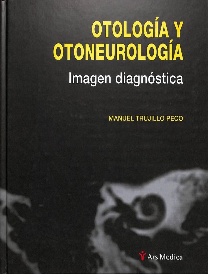 Otología y Otoneurología: Imagen Diagnóstica