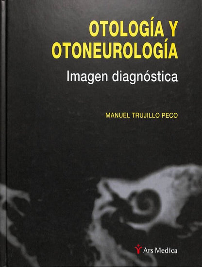 Otología y Otoneurología: Imagen Diagnóstica