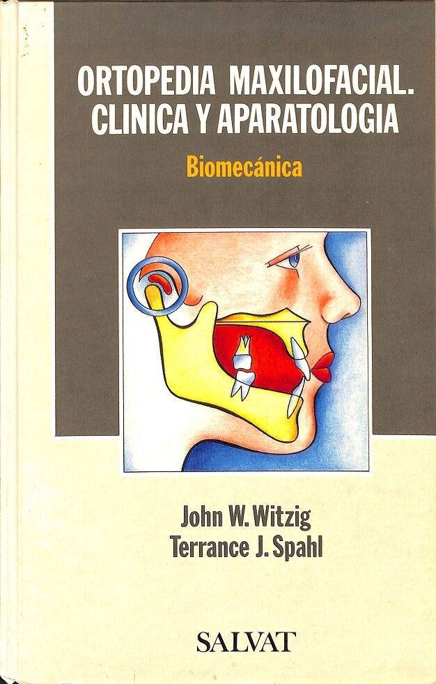 Ortopedia Maxilofacial