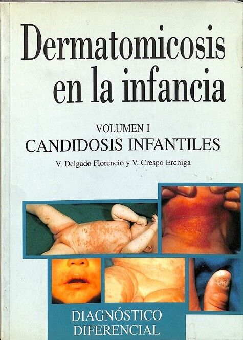 Diagnóstico Diferencial