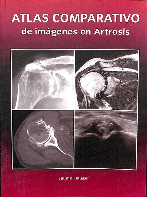 Atlas Comparativo de Imagenes en Artrosis