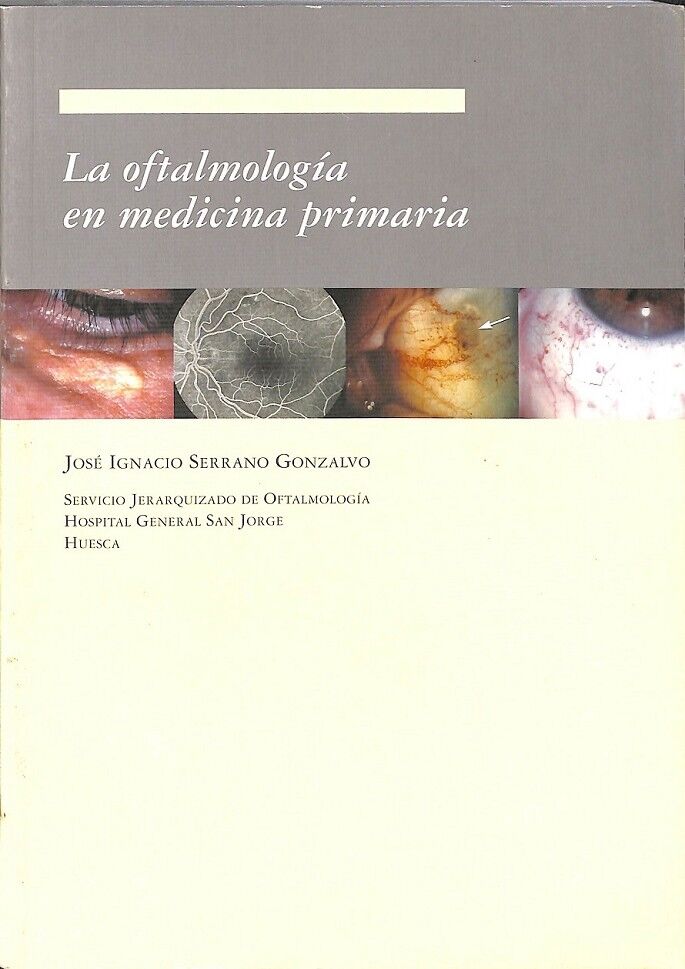 La Oftalmología en Medicina Primaria