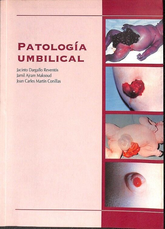 Patologia Umbilical