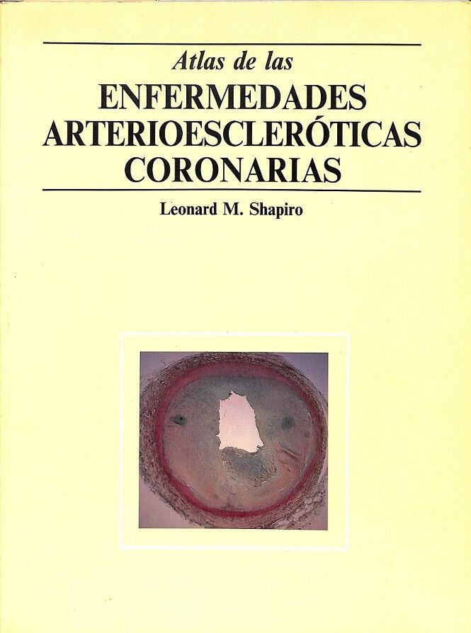 Atlas de las Enfermedades Arterioescleroticas Coronarias