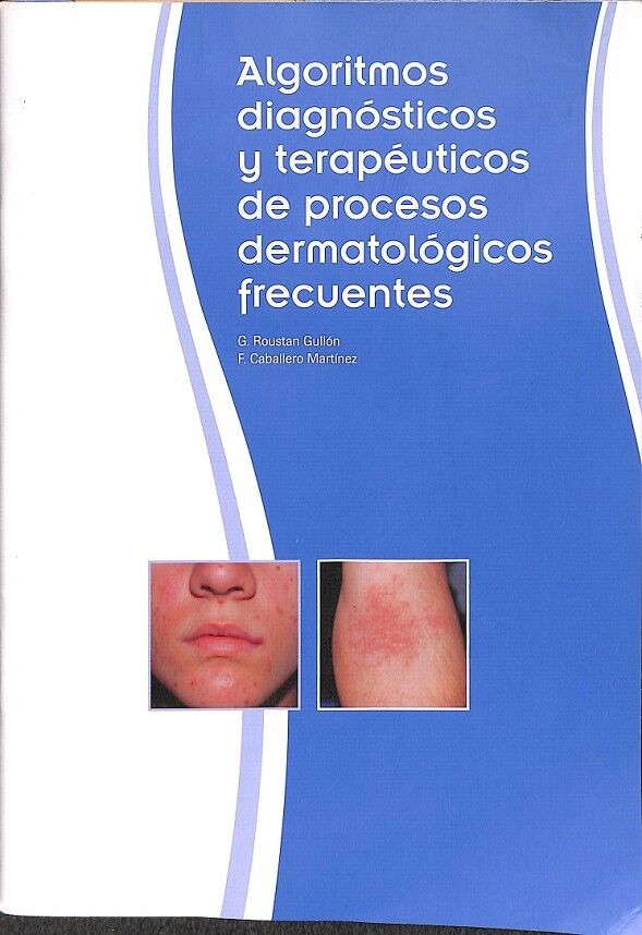Algoritmos Diagnosticos y Terapeuticos de Procesos Dermatologicos Frecuentes