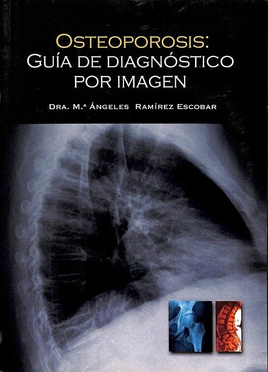 Osteoporosis Guia de Diagnostico por Imagen