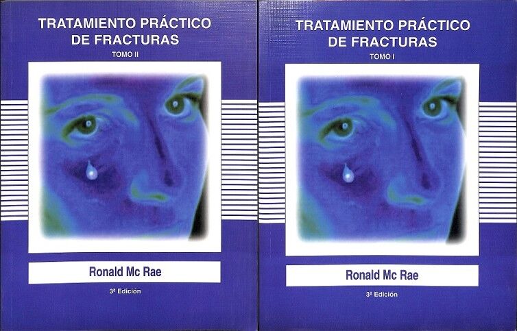 Tratamiento Práctico de Fracturas Tomo 1 y 2