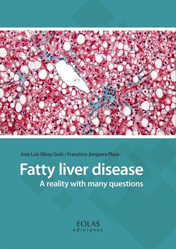 Fatty Liver Disease