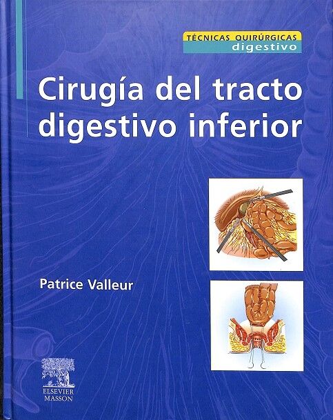 Cirugia del Tracto Digestivo Inferior