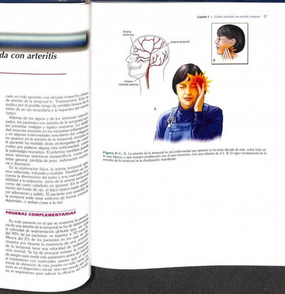 Atlas de Síndromes Dolorosos Poco Frecuentes