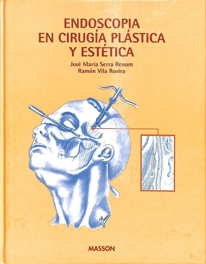 Endoscopia en Cirugía Plástica y Estética