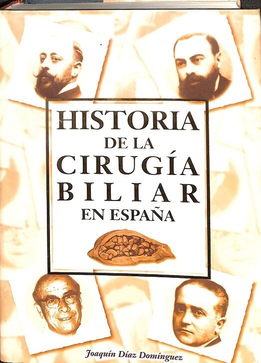 Historia de la Cirugía Biliar en España