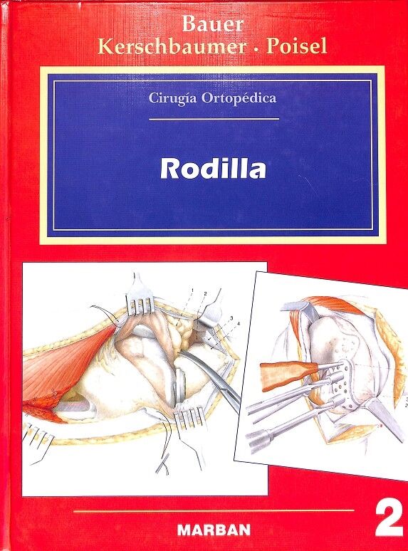 Rodilla Cirugia Ortopedica