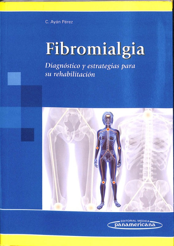 Fibromialgia