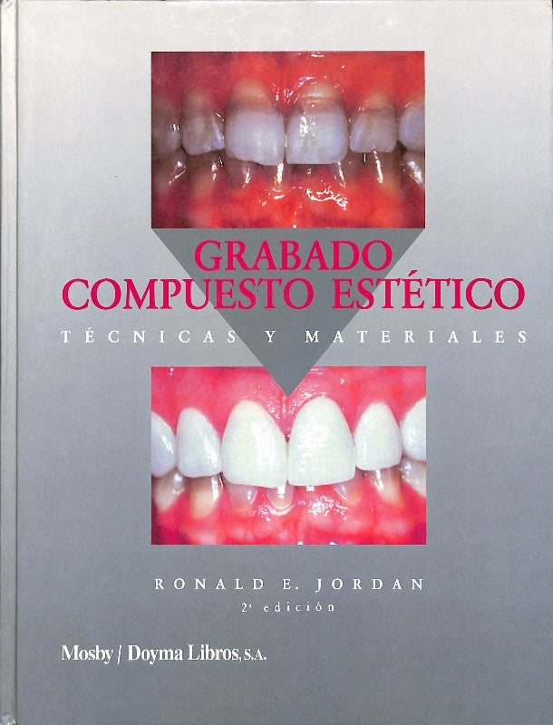 Grabado Compuesto Estético. Técnicas y Materiales