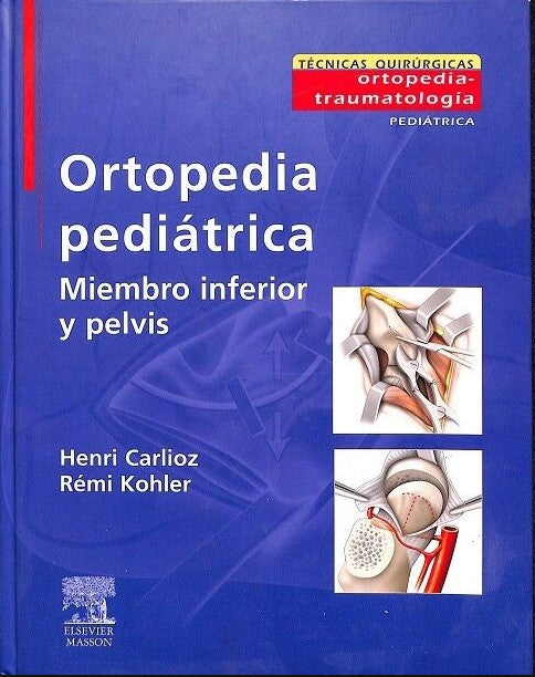 Ortopedia Pediátrica. Miembro Inferior y Pelvis
