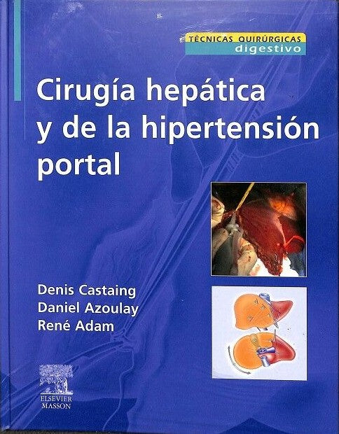 Cirugía Hepática y de la Hipertensión Portal