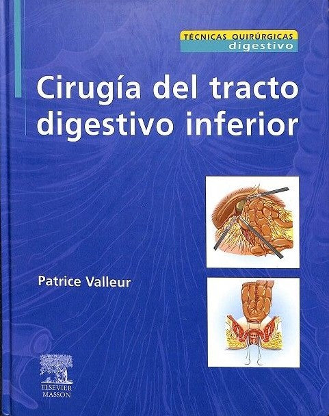 Cirugía del Tracto Digestivo Inferior