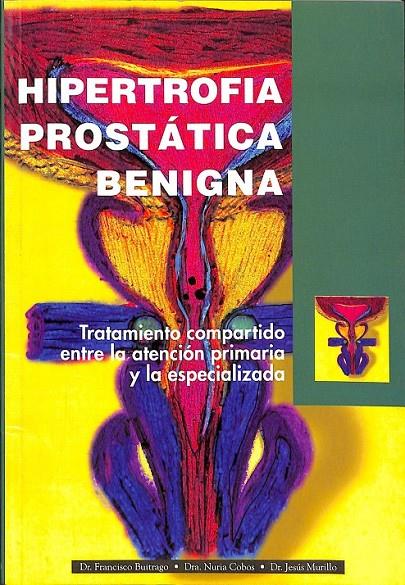 HIPERTROFIA PROSTATICA BENIGNA  | FRANCISCO BUITRAGO