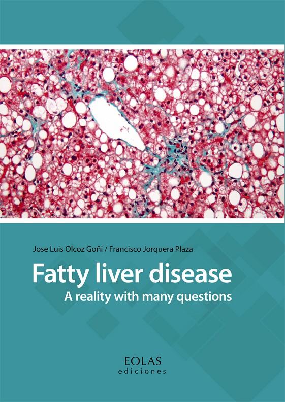 FATTY LIVER DISEASE (INGLÉS) | 9788416613977 | OLCOZ GOÑI, JOSE LUIS / JORQUERA PLAZA, FRANCISCO